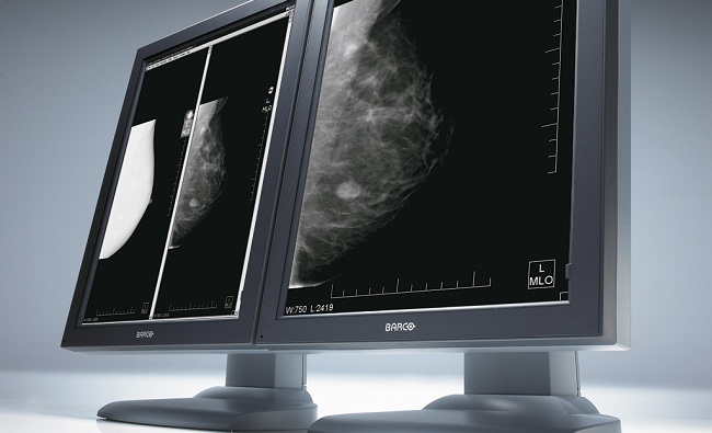 Digital Mammography In Sonipat And Delhi